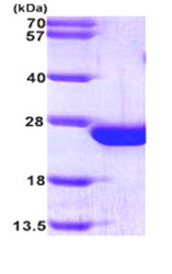 SDS-PAGE - Recombinant Human RAC2 protein (AB87665)