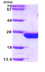 SDS-PAGE - Recombinant Human RAC2 protein (AB87665)