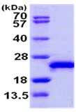 SDS-PAGE - Recombinant Human RAC3 protein (Tag Free) (AB103470)