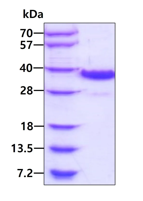 SDS-PAGE - Recombinant Human RACK1 protein (His tag N-Terminus) (AB119442)
