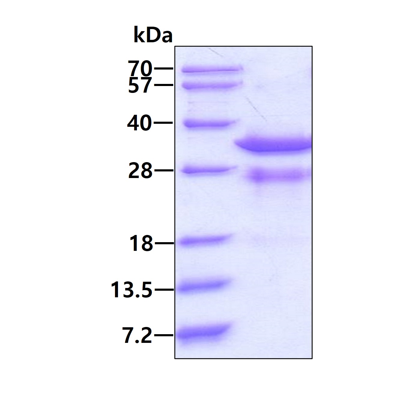 SDS-PAGE - Recombinant Human Rad1 protein (His tag N-Terminus) (AB97946)