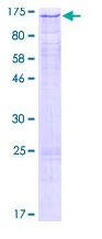 Recombinant Human Rad21 protein