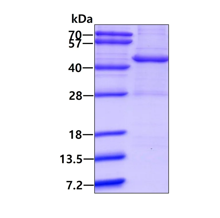 SDS-PAGE - Recombinant Human Rad51L1/RAD51B protein (denatured) (His tag N-Terminus) (AB174397)