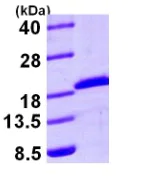 SDS-PAGE - Recombinant Human Rad6 protein (His tag N-Terminus) (AB95493)