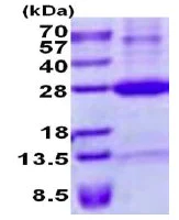 SDS-PAGE - Recombinant Human RAET1E protein (denatured) (His tag N-Terminus) (AB137171)