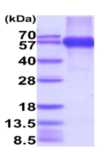 SDS-PAGE - Recombinant Human RAET1E protein (Fc tag C-Terminus + His tag C-Terminus) (AB227416)