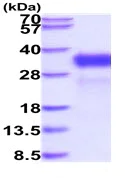 SDS-PAGE - Recombinant Human RAET1E protein (His tag) (AB227409)