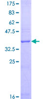 Recombinant Human RAMP1 protein