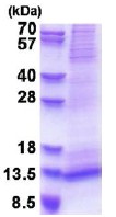 SDS-PAGE - Recombinant Human RAMP1 protein (denatured) (His tag N-Terminus) (AB177659)