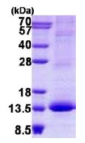 SDS-PAGE - Recombinant Human RAMP3 protein (His tag N-Terminus) (AB140554)