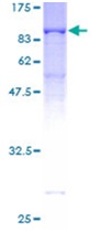 SDS-PAGE - Recombinant Human RanGAP1 protein (AB131750), expandable thumbnail