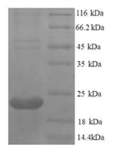 SDS-PAGE - Recombinant Human RANK protein (His tag) (AB240776)