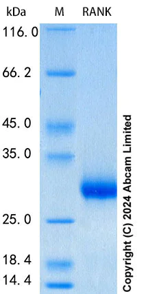 SDS-PAGE - Recombinant Human RANK Protein Standard (His tag) (AB316555)