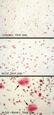 Functional Studies - Recombinant human RANKL protein (Active) (AB157289)