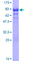 Recombinant Human RAP1/TERF2IP protein