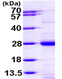 SDS-PAGE - Recombinant Human RAP1A protein (His tag N-Terminus) (AB97904)