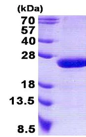 SDS-PAGE - Recombinant Human RAP2B protein (His tag N-Terminus) (AB140538)