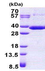 SDS-PAGE - Recombinant Human RARRES1 protein (denatured) (AB167883), expandable thumbnail