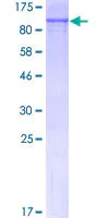 SDS-PAGE - Recombinant Human RARS protein (AB114873)