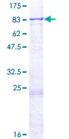 Recombinant Human RARS2 protein