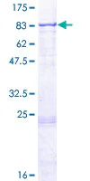 SDS-PAGE - Recombinant Human RARS2 protein (GST tag N-Terminus) (AB163465)