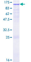 SDS-PAGE - Recombinant Human RASA1 protein (AB116964)