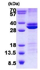SDS-PAGE - Recombinant Human RASSF3 protein (denatured) (His tag N-Terminus) (AB140570)