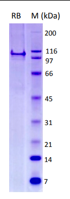 SDS-PAGE - Recombinant Human Rb protein (AB83205), expandable thumbnail
