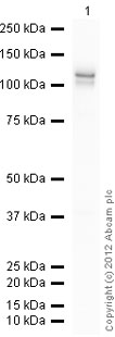 Western blot - Recombinant Human Rb protein (AB83205), expandable thumbnail