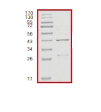 SDS-PAGE - Recombinant Human Rb protein (AB56270)