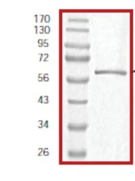 SDS-PAGE - Recombinant Human Rb protein (GST tag N-Terminus) (AB59982)