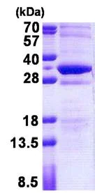 SDS-PAGE - Recombinant Human RB3 protein (His tag N-Terminus) (AB156740)