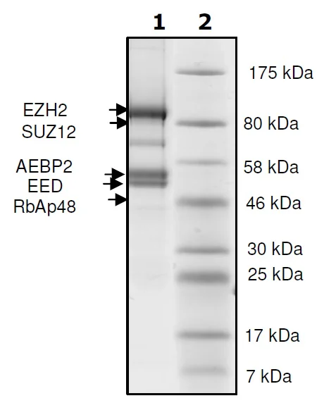 SDS-PAGE - Recombinant Human RBBP4 + EED + SUZ12 + AEBP2 + EZH2 (del Y153) protein (His N-Term, DDDDK N-Term) (AB271500)