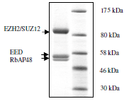 SDS-PAGE - Recombinant human RBBP4 + EED + SUZ12 + EZH2 protein (AB198157), expandable thumbnail