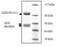 SDS-PAGE - Recombinant human RBBP4 + EED + SUZ12 + EZH2 protein (His tag N-Terminus, DDDDK tag N-Terminus) (AB198157)