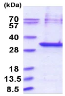 SDS-PAGE - Recombinant Human RBJ protein (His tag N-Terminus) (AB180338)