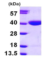 SDS-PAGE - Recombinant Human RBKS protein (His tag N-Terminus) (AB101665)