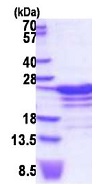 SDS-PAGE - Recombinant Human RBM18 protein (AB187430)