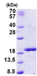 SDS-PAGE - Recombinant Human RBM3 protein (His tag N-Terminus) (AB156355)
