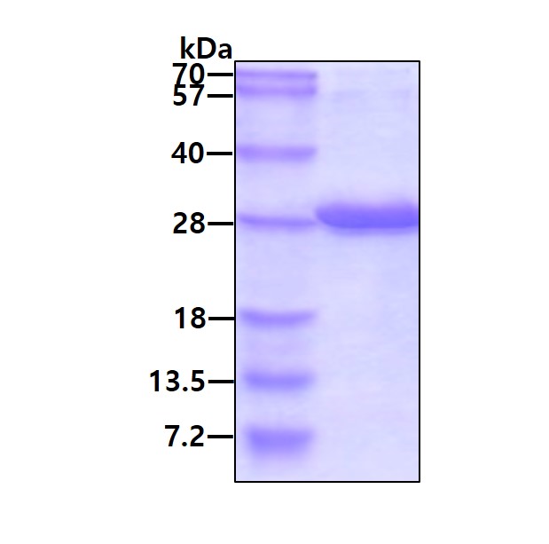 SDS-PAGE - Recombinant Human RBP1 protein (AB115723)