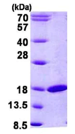 SDS-PAGE - Recombinant Human RBP2 protein (His tag N-Terminus) (AB156978)