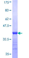 SDS-PAGE - Recombinant Human RBP3/IRBP protein (AB116892)