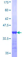 SDS-PAGE - Recombinant Human RBP3/IRBP protein (GST tag N-Terminus) (AB116892)