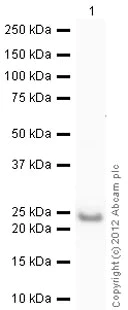 Western blot - Recombinant Human RBP4 protein (AB59967)