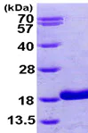 SDS-PAGE - Recombinant Human RBP5 protein (AB99438)