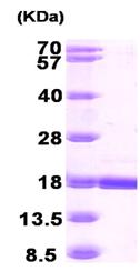 SDS-PAGE - Recombinant Human RBP7 protein (His tag N-Terminus) (AB104483)