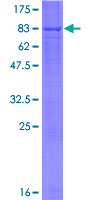 Recombinant Human RBPJL protein