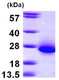 SDS-PAGE - Recombinant Human RCL protein (His tag N-Terminus) (AB100943)