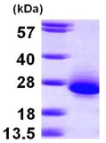 SDS-PAGE - Recombinant Human RCL protein (His tag N-Terminus) (AB100943)