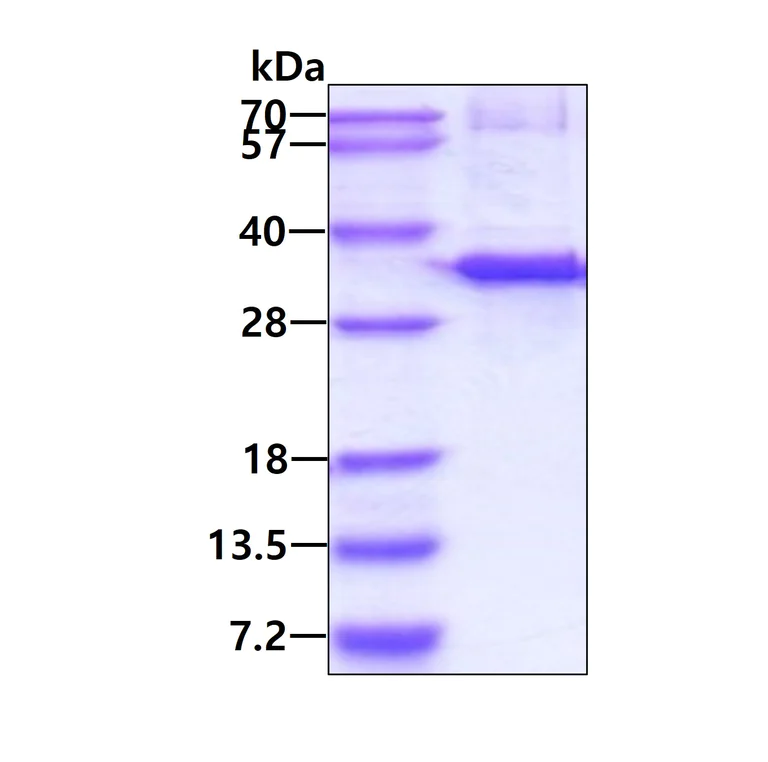 SDS-PAGE - Recombinant Human RDH12 protein (His tag N-Terminus) (AB119458)